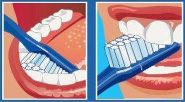 cara Interna de los dientes