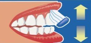 cara externa de los dientes