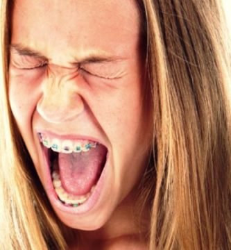 Que puede reemplazar la cera para brackets
