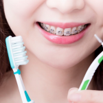 cepillar los brackets