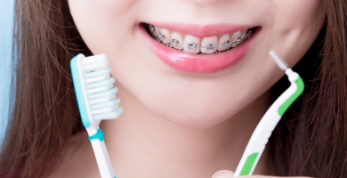 cepillar los brackets