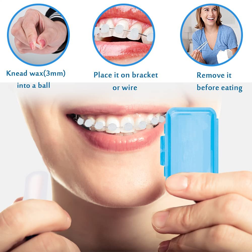 cera de ortodoncia para el cuidado dental