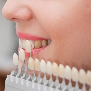 Odontologia estetica