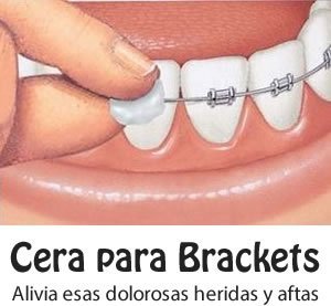 cera para brackets y ortodoncia precio, donde la venden, mifarma, como hacer, mercadolibre, inkafarma cuanto dura