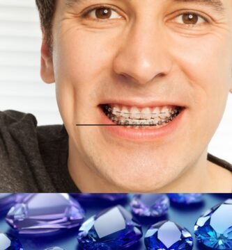 Brackets de Zafiro