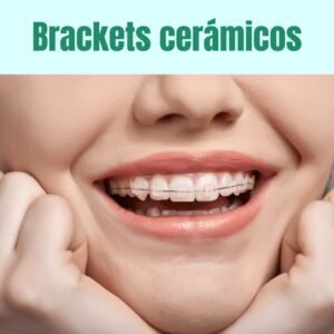 brackets cerámicos